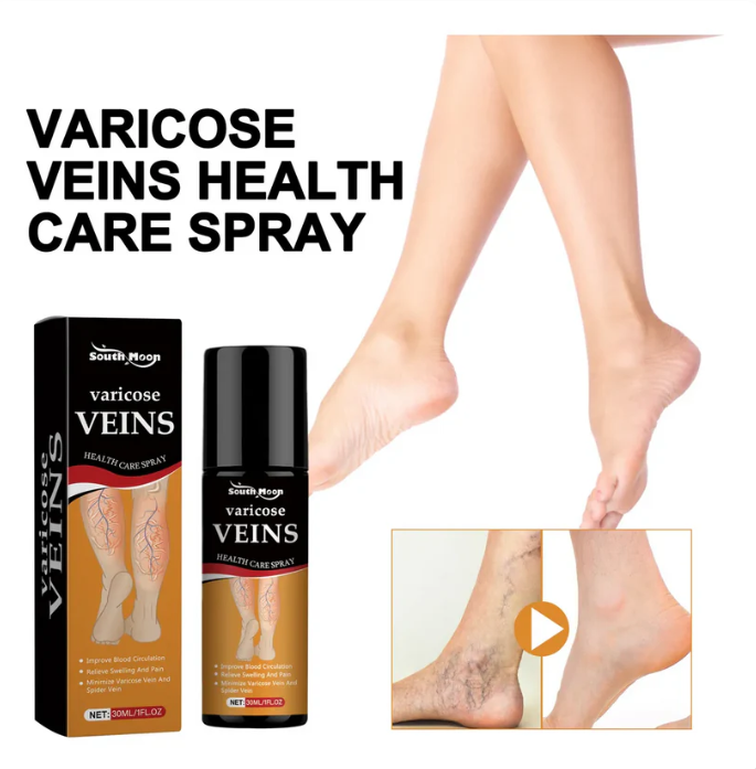 Varicose Veins Spray – Natural Herbal Formula for Fast Relief