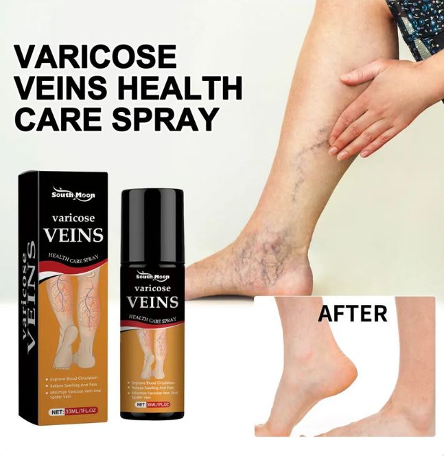 Varicose Veins Spray