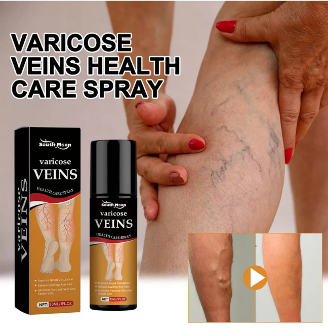 Varicose Veins Spray – Natural Herbal Formula for Fast Relief