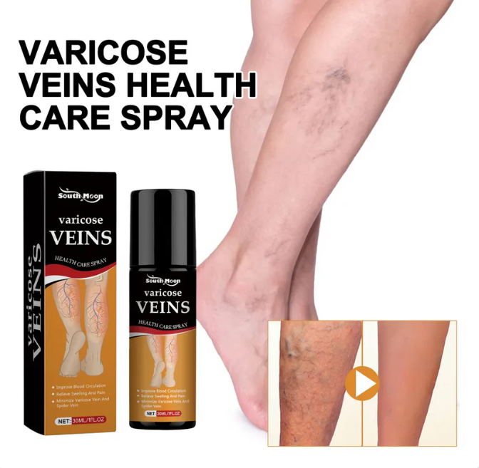 Varicose Veins Spray – Natural Herbal Formula for Fast Relief